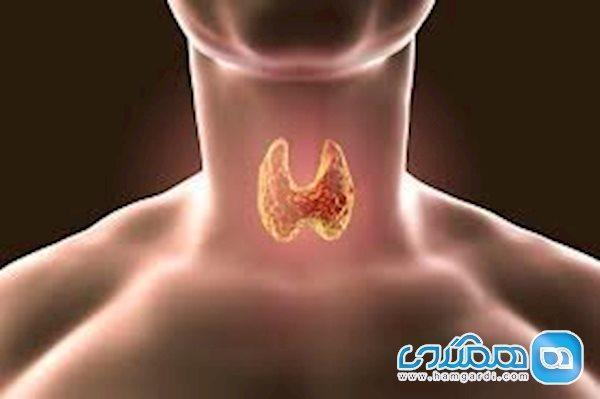 آیا بیماران تیروئیدی بیشتر در معرض ابتلا به کرونا هستند؟ آیا بیماران تیروئیدی بیشتر در معرض ابتلا به کرونا هستند؟