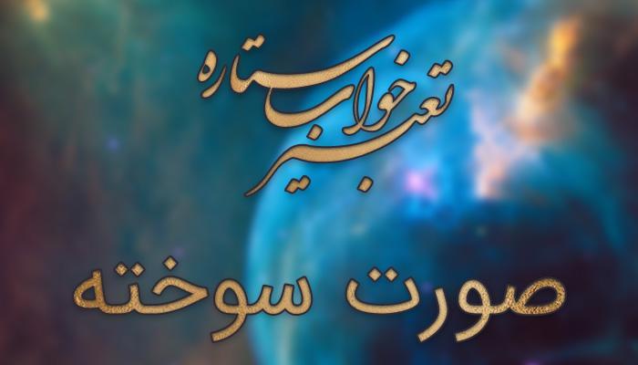 تعبیر خواب صورت سوخته (سوختگی صورت)