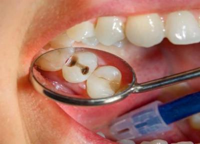 آیا ژنتیک در مقاومت دندان ها به پوسیدگی مؤثر است؟