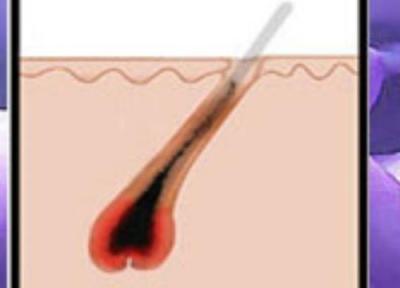 موهای زیرپوستی ازکجا می آیند؟