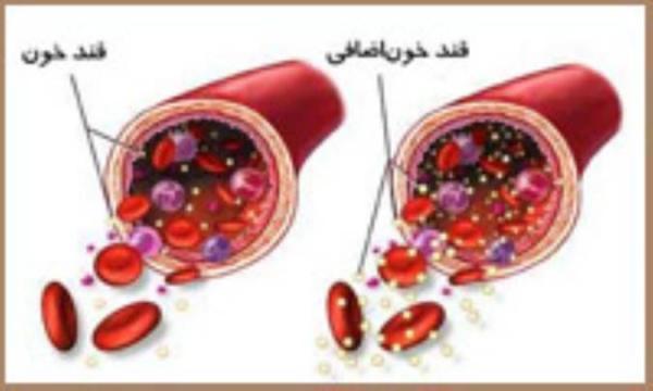 رژیم غذایی برای قند خون بالا
